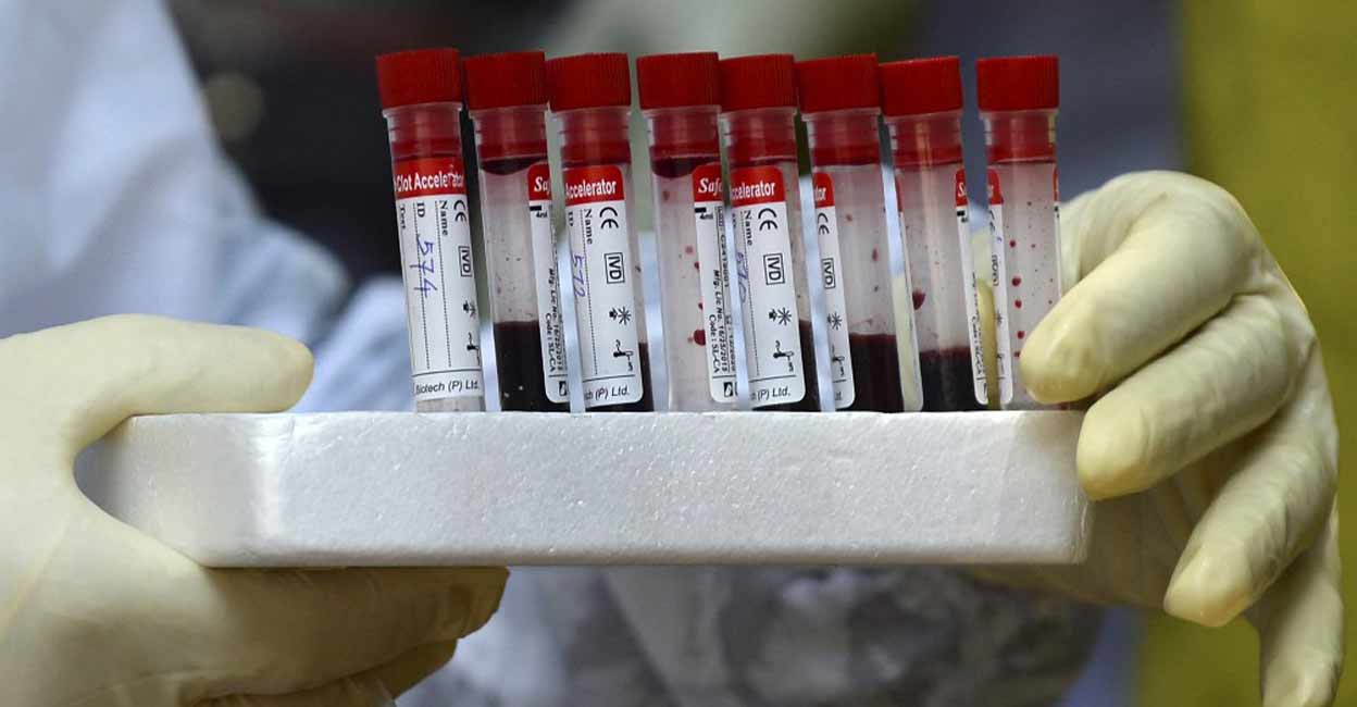 Haemophilia is usually an inherited bleeding disorder in which the blood doesn’t clot properly. Photo: AFP